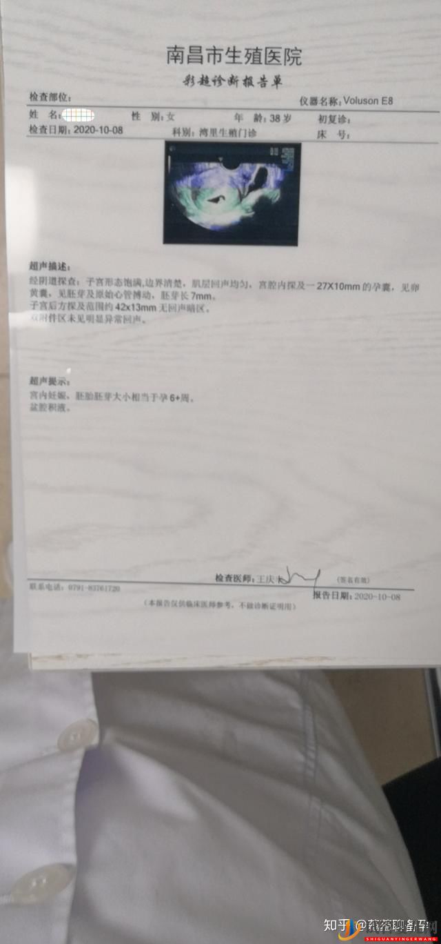 分享四例高齡試管成功案例,最大的45歲,給高齡孕媽(圖8)