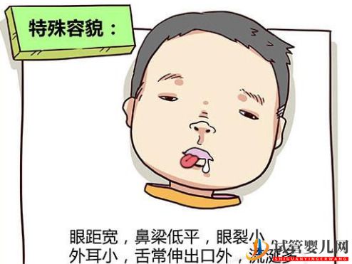 頭胎是唐氏兒，二胎備孕怎么預防唐氏？做三代試管可以預防嗎？(圖1)
