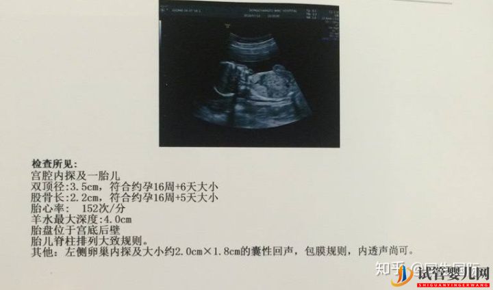 女人做了試管人就廢了其中的辛酸苦不堪言(圖2)