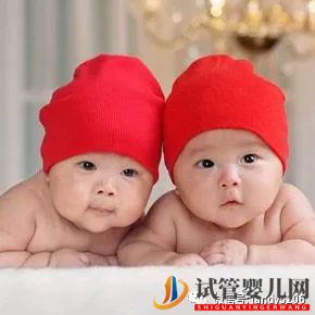 你喜歡哪對雙胞胎小孩？測你的孩子將來會有出息嗎？(圖2)