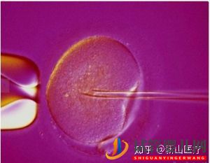 試管嬰兒幾代好一代、二代、三代先辨別清楚(圖5) 試管嬰兒幾代好一代、二代、三代先辨別清楚(圖5)