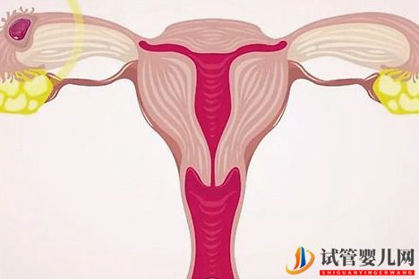 女性子宮內膜過薄對做試管嬰兒有什么影響？(圖1)