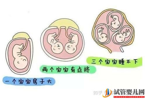 試管嬰兒雙胞胎成功率有多大有哪些風險(圖4)