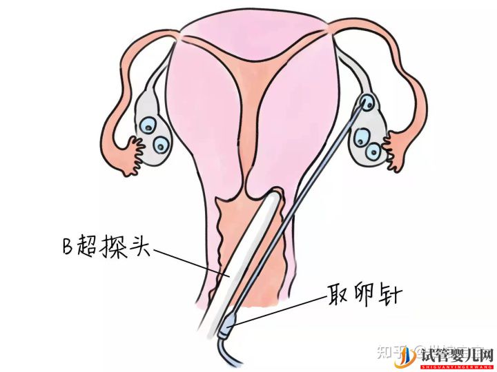 很多人說試管嬰兒可能不會是自己親生的(圖1)