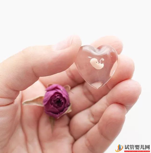 美國(guó)試管可以做雙胞胎嗎風(fēng)險(xiǎn)大不大(圖3)