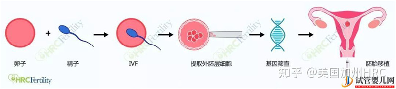 要去美國(guó)看病別怕!小C帶您全面了解美國(guó)試管嬰兒(圖13)