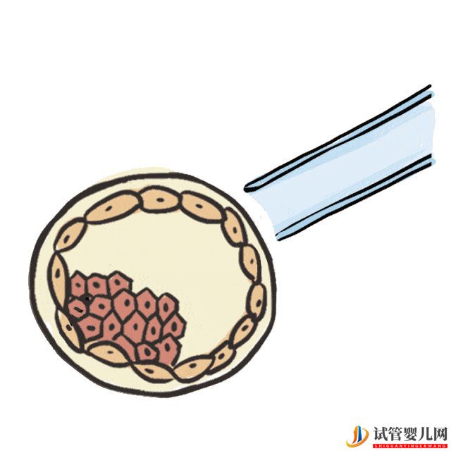 赴美試管嬰兒要經歷哪些流程呢(圖6)