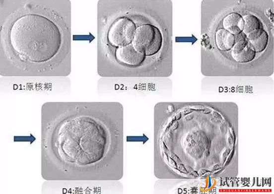 中美試管嬰兒的差異在哪里(圖3)