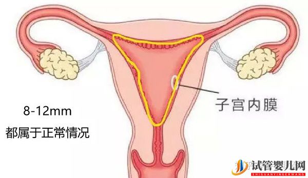 患有縱膈子宮赴美做試管能妊娠嗎(圖5)