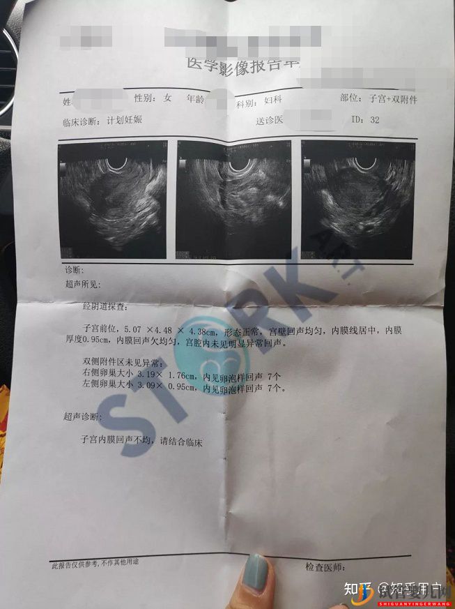 28歲,單身,我去泰國凍卵了(圖3)