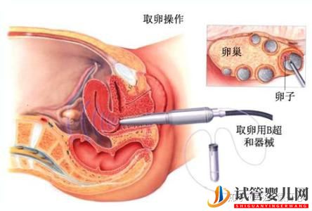 干貨分享——泰國試管嬰兒詳細(xì)流程攻略(圖5)