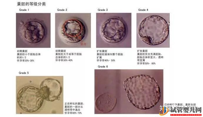 囊胚級別劃分,什么級別的囊胚成功率最高(圖4)