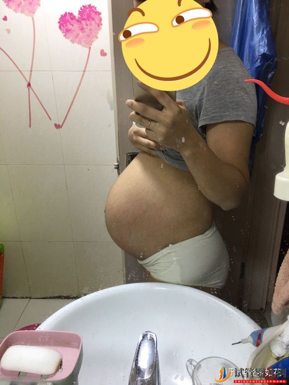 認真臉我覺得泰國試管技術(shù)真的不錯(圖3) 認真臉我覺得泰國試管技術(shù)真的不錯(圖3)
