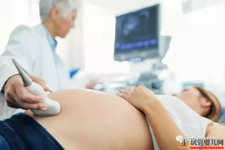 美國試管嬰兒雙胞胎你得具備這些條件!(圖6)