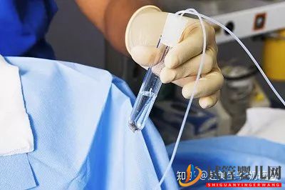 美國試管嬰兒各環(huán)節(jié)時間安排,整個流程需要多少天(圖5)