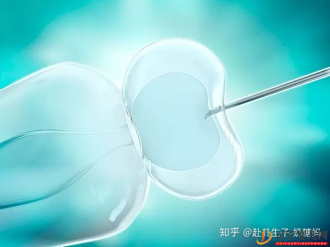 美國試管嬰兒各環(huán)節(jié)時間安排,整個流程需要多少天(圖1)