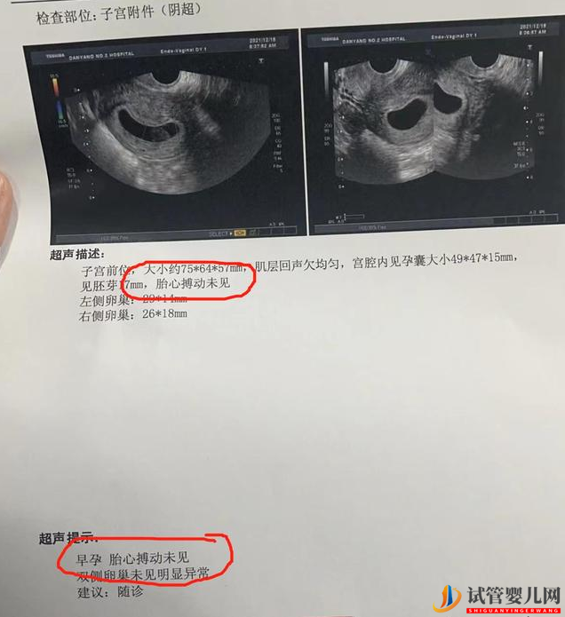 做試管嬰兒可以避免胎停嗎？(圖1)