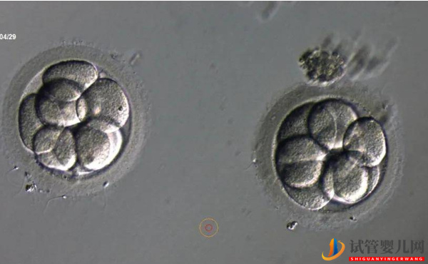 2pn胚胎是不是優(yōu)質(zhì)胚胎？移植成功率說明了一切(圖1)