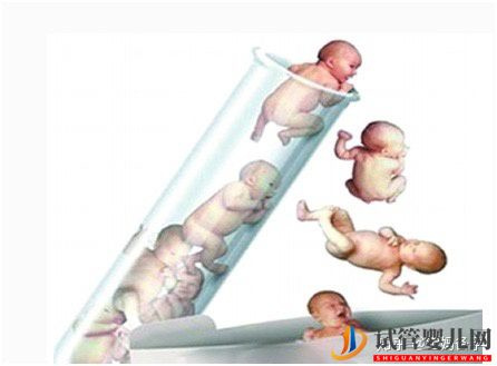 符合這三個(gè)條件中的其中一個(gè),就可以做試管嬰兒了(圖1)