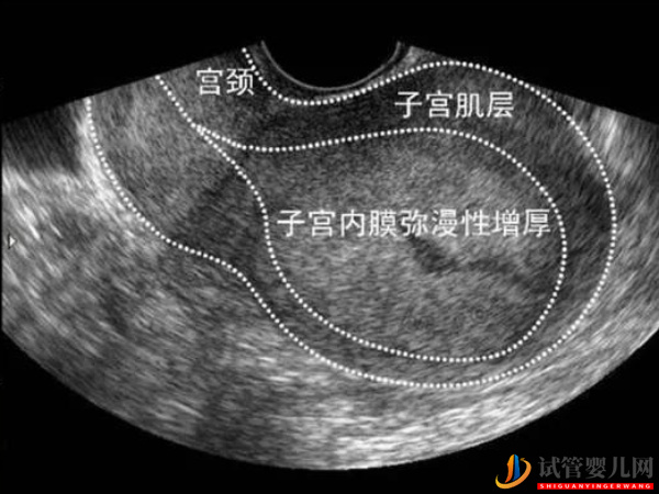 amh0.34儲備功能還沒衰竭(圖1)