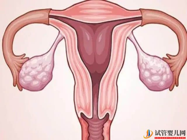 子宮肌瘤做試管嬰兒影響胚胎著床的成功率嗎？(圖1)