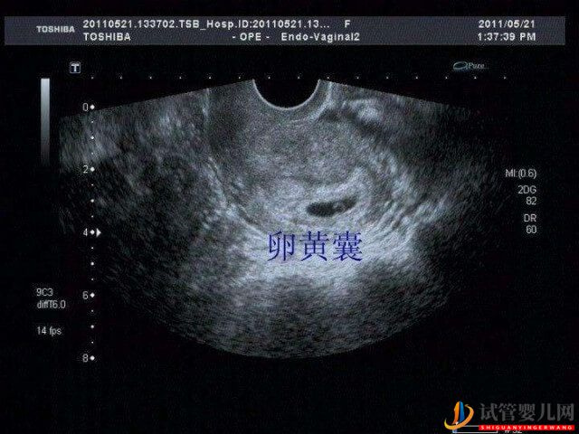 試管嬰兒移植胚胎懷孕后卵黃囊大概在多久會出現？(圖1)