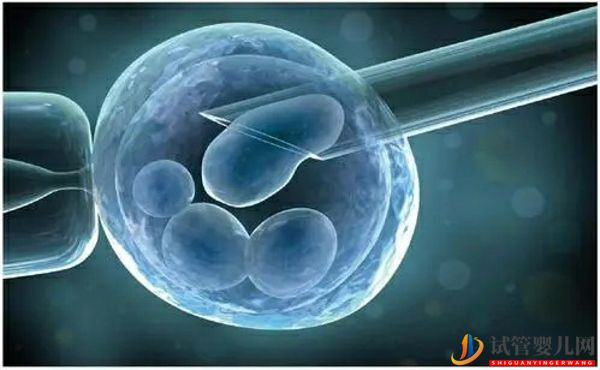 國內(nèi)精子庫精子做試管費(fèi)用明細(xì)(圖4)