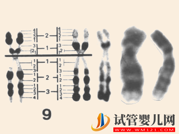9號染色體決定什么：出現嵌合、三體等異常后果很嚴重(圖1)