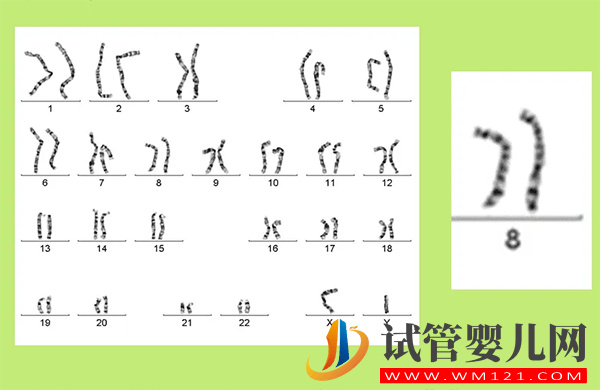 8號染色體異常會怎樣 偏多、缺失、三體是什么原因(圖1)