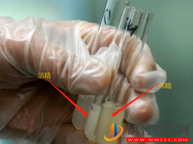 男性死精和活精差異盤點，一張圖帶你兩者表面區別(圖1)