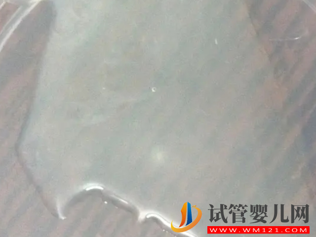 男性死精和活精差異盤點，一張圖帶你兩者表面區別(圖2)