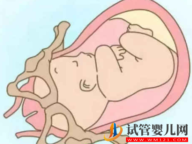 一張圖分清全入盆和半入盆區(qū)別，通過這3個表現(xiàn)在家可自判(圖1)