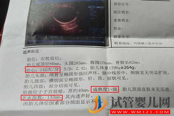 bpd、hc、ac、fl正常值對照表一覽，附B超數據看男女方法(圖2)