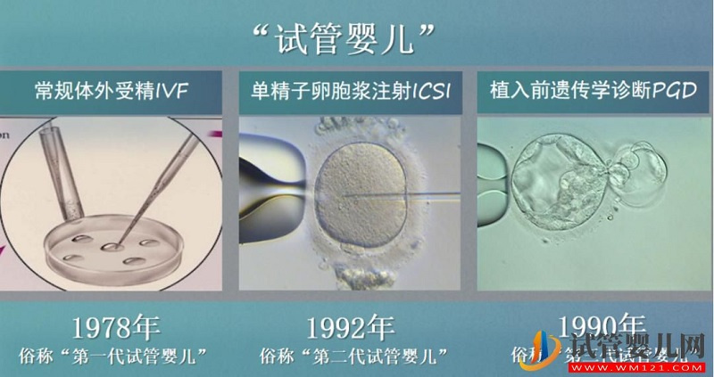 試管嬰兒技術走到了哪一步？專家解答→(圖4)