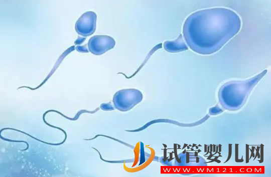 精子頭部畸形有什么影響，胎兒會產生畸形嗎？81次閱讀(圖2)