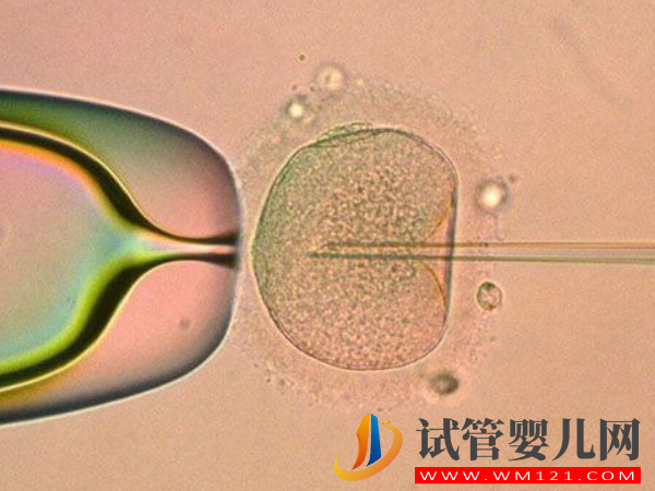 你不知道的第四代試管嬰兒優(yōu)缺點(diǎn)，和一二三代都不同(圖3)