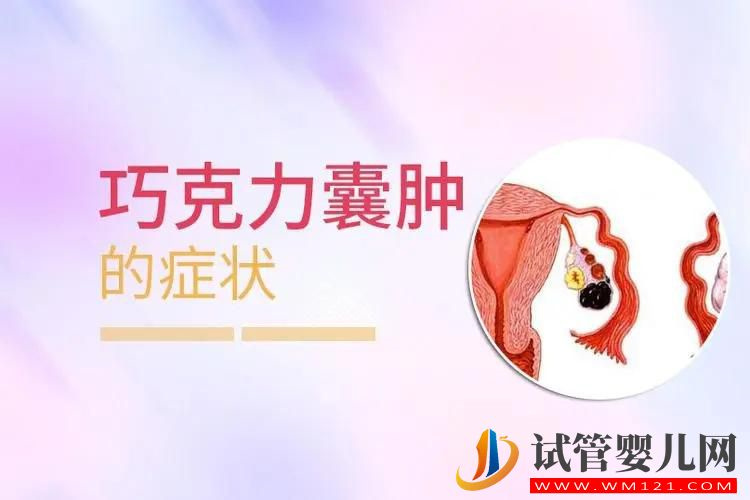 巧克力囊腫有哪些癥狀?會引起不孕嗎?(圖1) 巧克力囊腫有哪些癥狀?會引起不孕嗎?(圖1)