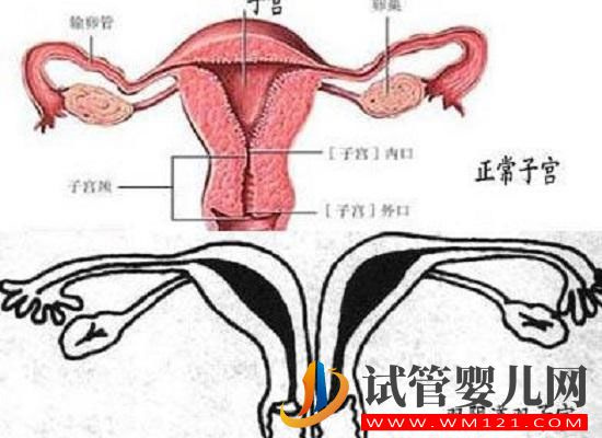 帶你了解什么是縱膈子宮，別再和雙子宮搞混了(圖1)