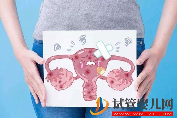卵巢囊腫對試管助孕有影響嗎？聽聽專家怎么說(圖3)