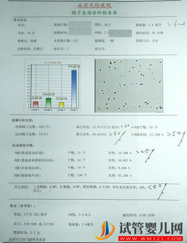 常規(guī)精液檢查(圖1) 常規(guī)精液檢查(圖1)