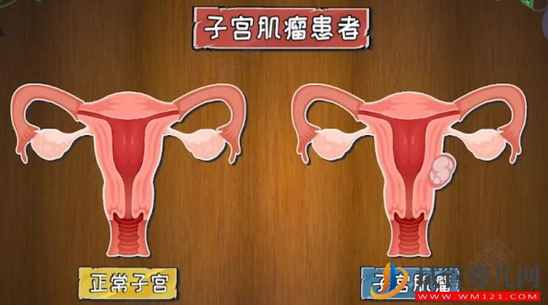 影響試管嬰兒成功率的子宮內(nèi)環(huán)境有哪些(圖2) 影響試管嬰兒成功率的子宮內(nèi)環(huán)境有哪些(圖2)