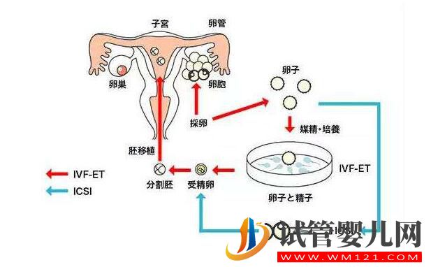 試管嬰兒移植后胚胎著床是什么感覺?(圖1) 試管嬰兒移植后胚胎著床是什么感覺?(圖1)