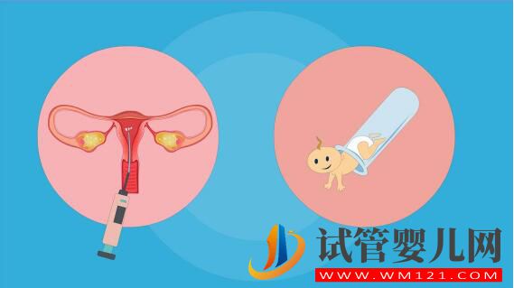 人工授精和試管嬰兒詳細介紹及對比？(圖3)