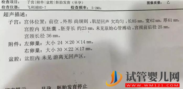 胎停育后能再次懷孕嗎？(圖2)