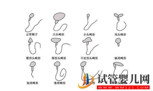 試管嬰兒是用老公的精子嗎?(圖2) 試管嬰兒是用老公的精子嗎?(圖2)