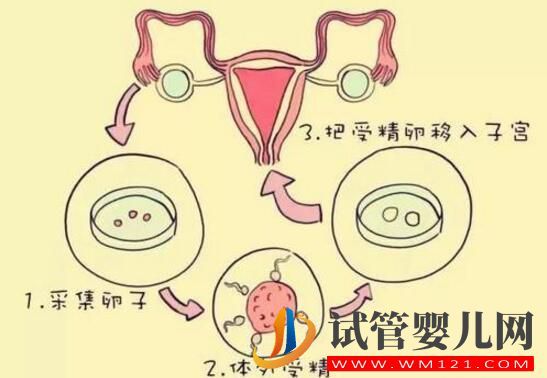 哪些因素影響試管嬰兒移植的成功?(圖2) 哪些因素影響試管嬰兒移植的成功?(圖2)
