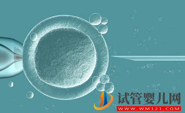 想生二胎什么情況可以做試管嬰兒?(圖4) 想生二胎什么情況可以做試管嬰兒?(圖4)