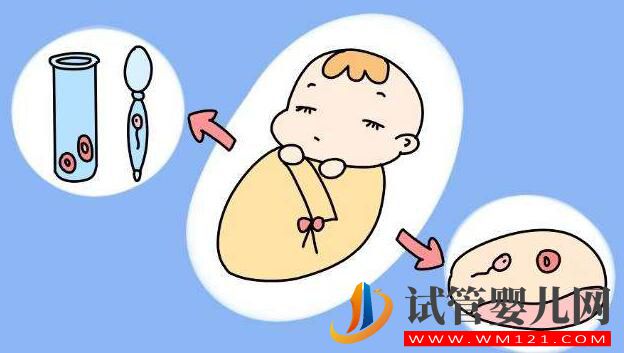 高齡婦女為什么要選擇試管嬰兒?(圖3) 高齡婦女為什么要選擇試管嬰兒?(圖3)