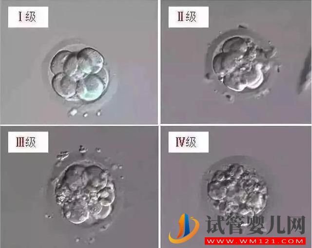 試管嬰兒胚胎選擇看“顏值”,長得好看才能被移植!(圖4) 試管嬰兒胚胎選擇看“顏值”,長得好看才能被移植!(圖4)
