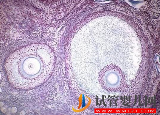 試管嬰兒取卵時空卵泡B超能看出來嗎？(圖2)